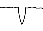 Graph Dip